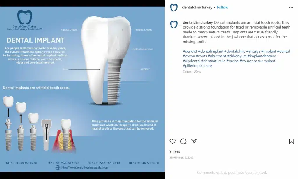 Educational Instagram infographic by a dental clinic showing the structure of a dental implant, including crown, abutment, and titanium root, with a comparison of implant parts and explanation of benefits.